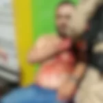 Motorista por aplicativo é esfaqueado após discussão de trânsito em Campina Grande